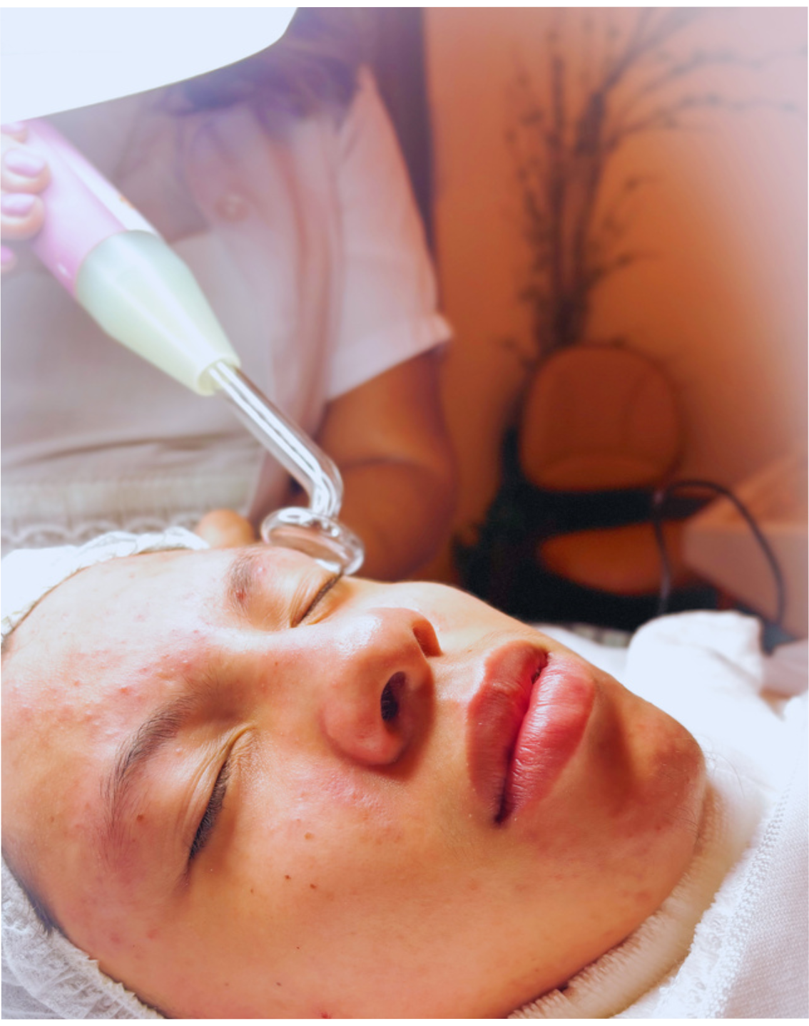 Tratamento facial